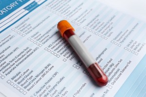 blood tests in aging adults